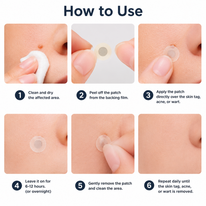 ODALIT® 2-in-1 Microneedle & Hydrocolloid Patch🍀| Removes Raised Moles, Acne, Flat Warts & Skin Tags | Helps Improve Wrinkles, Scars & Blemishes | Invisible Patches for Face & Body