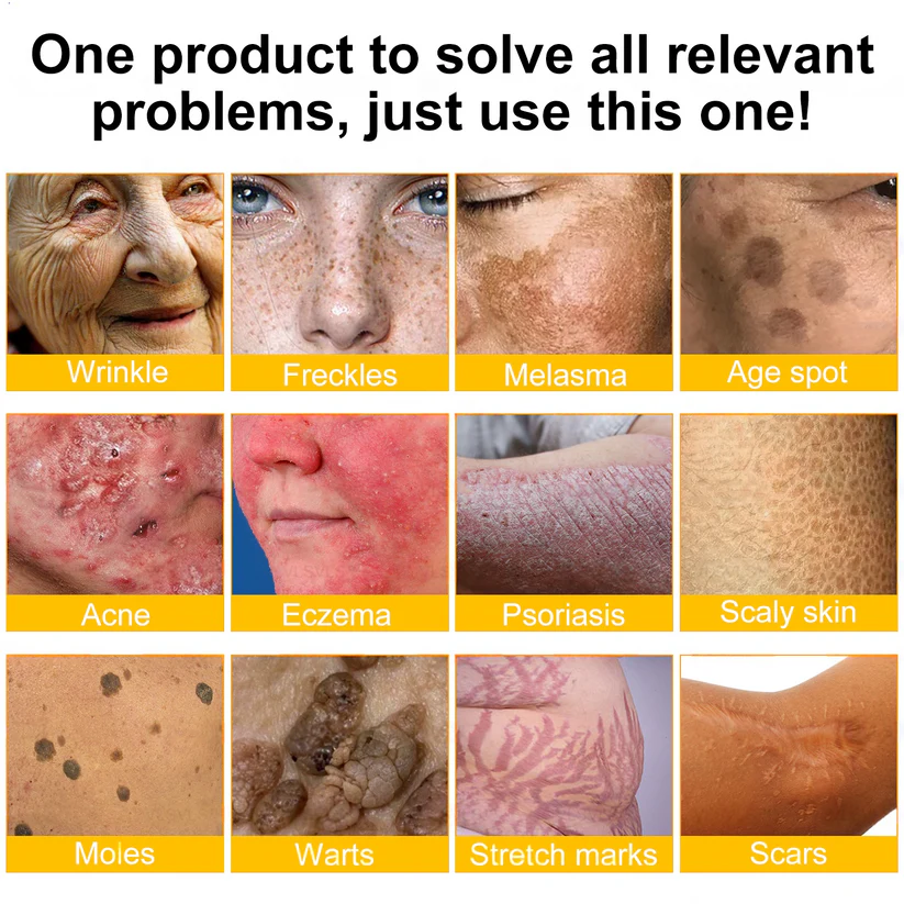 FDA Approved: ODALIT® Bee Venom Skin Restoration Cream — 🔥Limited Time 60% OFF🔥
