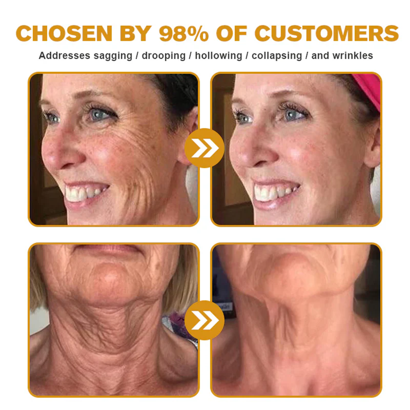 FDA Approved: ODALIT® Bee Venom Skin Restoration Cream — 🔥Limited Time 60% OFF🔥
