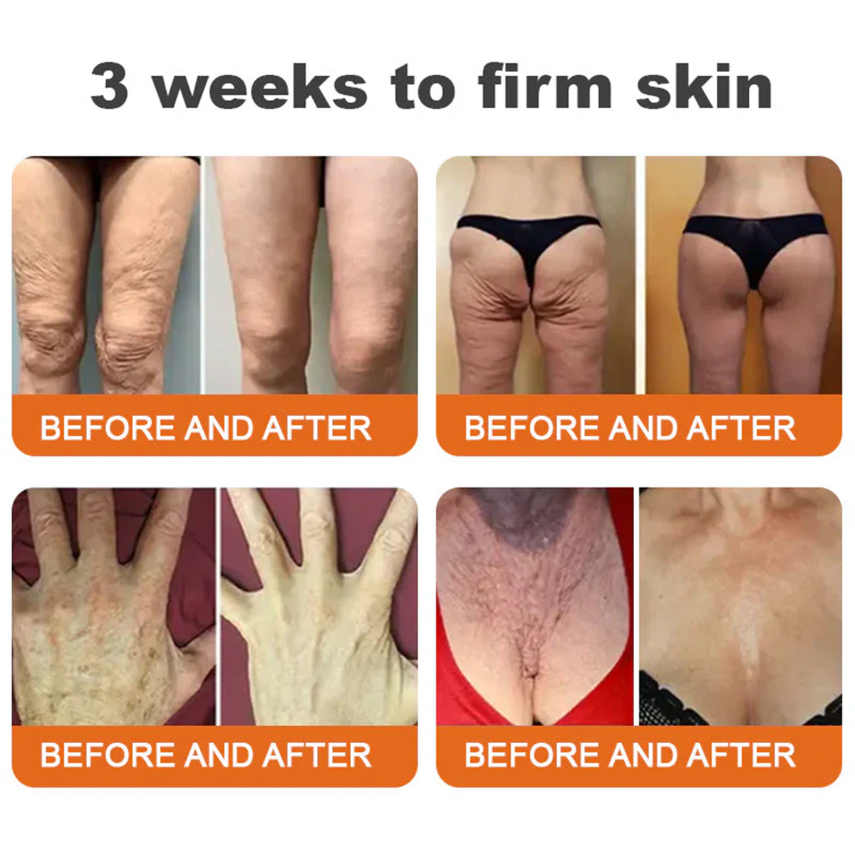FDA Approved: ODALIT® Bee Venom Skin Restoration Cream — 🔥Limited Time 60% OFF🔥