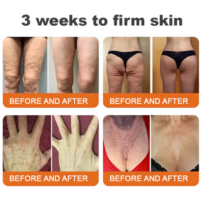FDA Approved: ODALIT® Bee Venom Skin Restoration Cream — 🔥Limited Time 60% OFF🔥