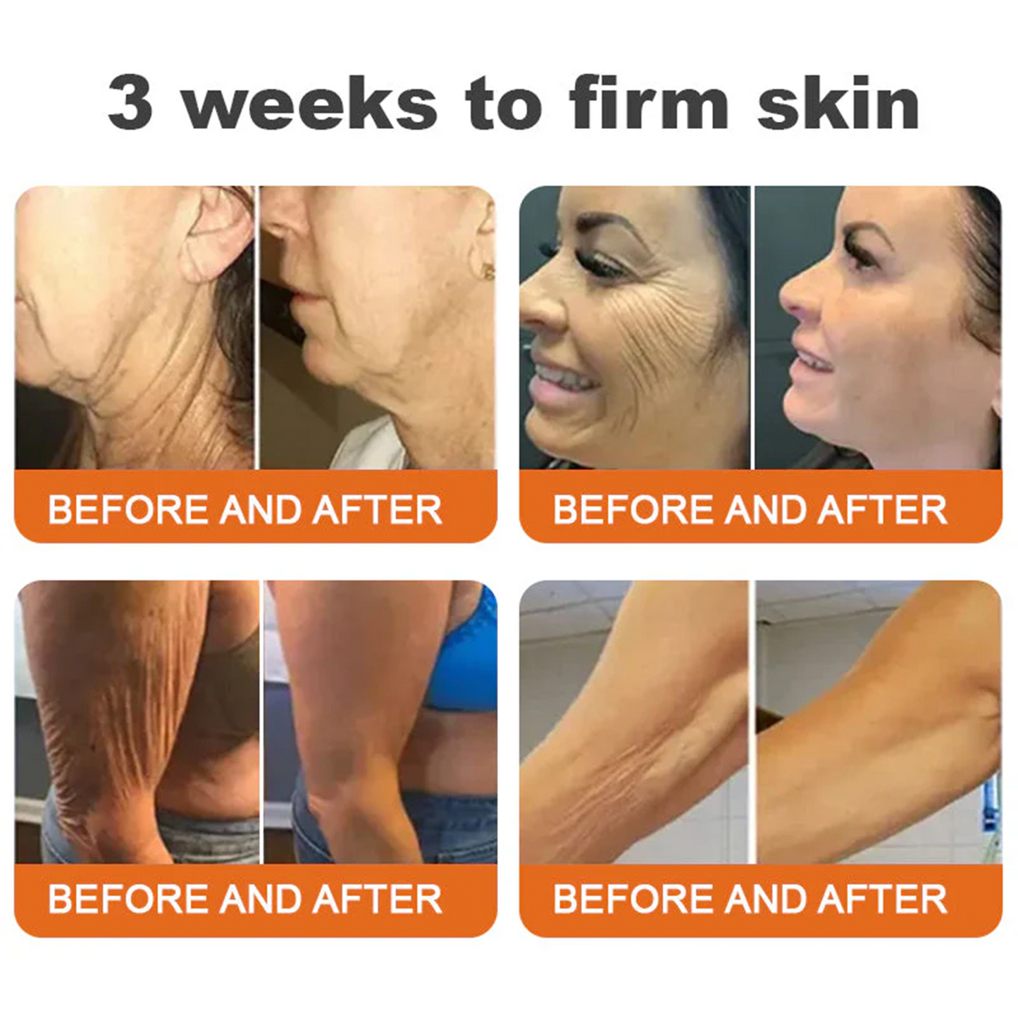 FDA Approved: ODALIT® Bee Venom Skin Restoration Cream — 🔥Limited Time 60% OFF🔥