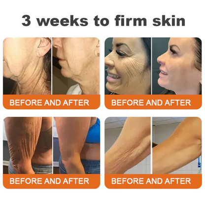 FDA Approved: ODALIT® Bee Venom Skin Restoration Cream — 🔥Limited Time 60% OFF🔥