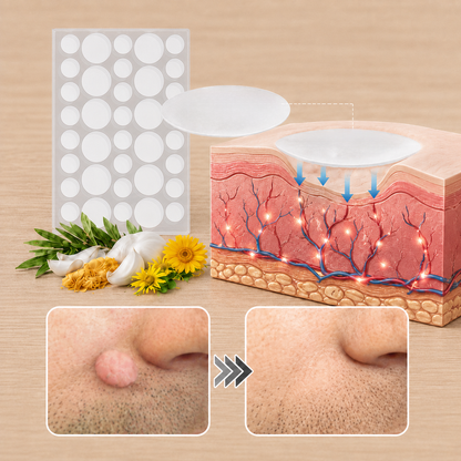 ODALIT® 2-in-1 Microneedle & Hydrocolloid Patch🍀| Removes Raised Moles, Acne, Flat Warts & Skin Tags | Helps Improve Wrinkles, Scars & Blemishes | Invisible Patches for Face & Body
