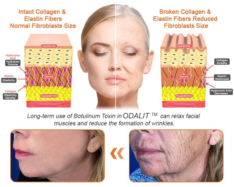 FDA Approved: ODALIT® Bee Venom Skin Restoration Cream — 🔥Limited Time 60% OFF🔥