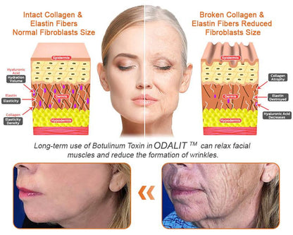 FDA Approved: ODALIT® Bee Venom Skin Restoration Cream — 🔥Limited Time 60% OFF🔥